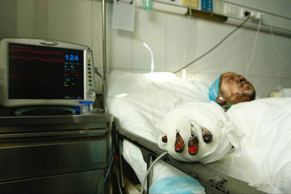 号外！号外！郑州一老旧小区凌晨突发火灾 一家四口被烧伤